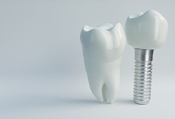model of a real tooth next to a dental implant in Stephens City 