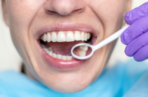 Close up of dentist inspecting patient’s teeth with dental mirror